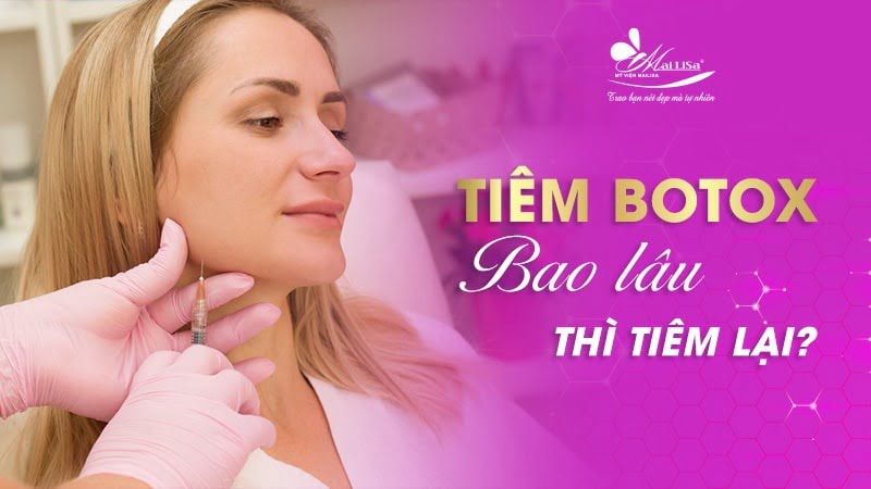 tiem-botox-bi-sung