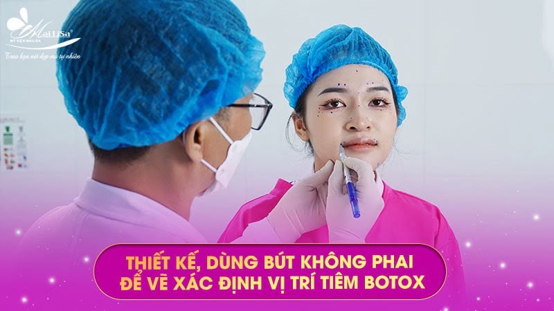 tiem-botox-thon-gon-ham