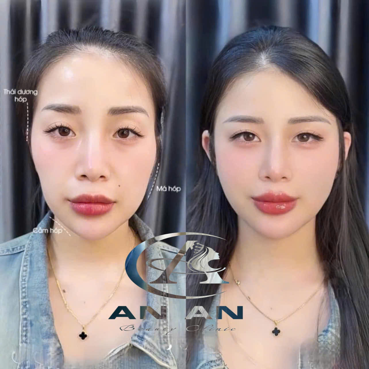 ANAN